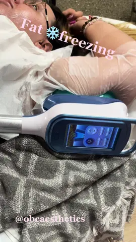 Fat freezing ❄️🤩 arms & stomach #foryoupage #londongirl #fyp #BeautyTok #fatloss #fypシ゚viral #weightloss #weightlosstransformation 