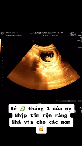 Bé 🐉 của mẹ #giađìnhbầubí  