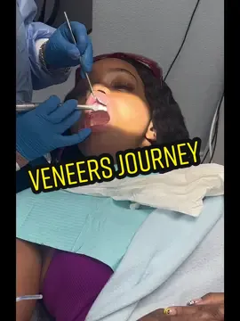 I love my new smile 🥰 #veneersjourney #veneers #veneerscheck #veneertok #miamidentist #newsmilecheck #newsmilewhodis #newsmile #newsmilenewyou #miami #newmewhodis #smiletransformation #smiletransition #smilemakover #miamidentalcare #treatyourself #teethtok 