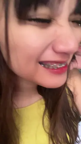 Pasabog ang contact lens vebs!!! 