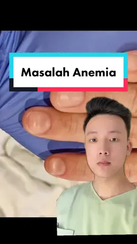 Ada yang pernah mengalami ? #education #health #fypage #fyp #TikTokImpact #skin #anemi 