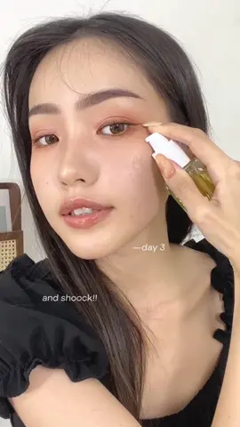best best best buat jerawat ✔️✔️ #glad2glow #skincaretips #acnetreatment #skincareroutine 