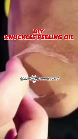 Peeling oil #darkknuckleoil #fyf  #fyp #peelingoil   