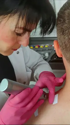 Medical shoulder skin examination #femaleasmr #asmrvideo #asmrsounds #relaxingsounds #asmr #asmrroleplay #examination #exam #relaxingvideos 