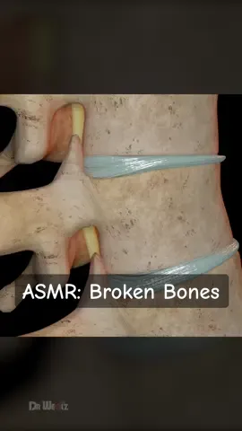 ASMR: Broken Bones #3d #animation #asmr #bones #spine 