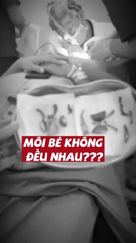 2 cánh môi bé không đều nhau có làm sao không? #thammycobe🦋 #tantrangcobe #bacsytuanduong #thammytuanduong #xuhuongtiktok 