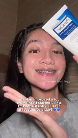 my holy grail 💙 I use this as my facial wash every night #panoxyl #panoxylfacewash #panoxyljourney #panoxylresults #fyp #fypシ #fypage #fypシ゚viral #fypdongggggggg #foryou #foryoupage #foryourpage #tiktokfinds #tiktokfindsyouneed #affiliate #affiliatemarketing #ugc #ugccreator #ugcph #ugcphilippines #ugccommunity #ugccreators #ugcneeded #ugcneededph #ugccontent #skincare #skincareroutine #skincareforacne #acne #acnejourney #acneprone #acneproneskin #skincareforacneproneskin 