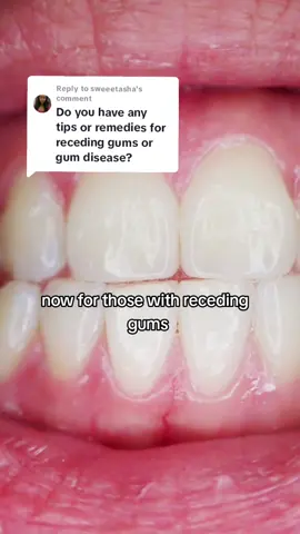 Replying to @sweeetasha Maintain Healthy Gums & Teeth #teethcare #gumcare #oilpulling #probiotics 
