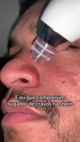#VozDosCriadores #shein #cravos #sheincares #fy #limpezadepele 