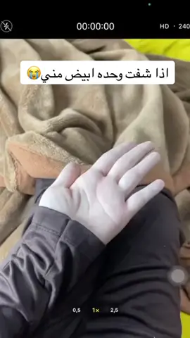 #البياض #البياض #خلطات_تبييض #تفتيح_البشرة #شعب_الصيني_ماله_حل😂😂 #مالي_خلق_احط_هاشتاقات #كريم_حب_الشباب #تك_توك #هشتاق_السعوديه 
