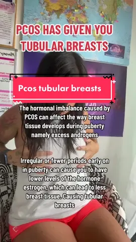 Another weird pcos symptom. Tubular breasts! Do you atruggle with this? #pcoscoachnikki #pcoscoachnikkicommunity #pcos #pcoscoachnikkireview #pcosweirdsymptoms #tubularbreasts 