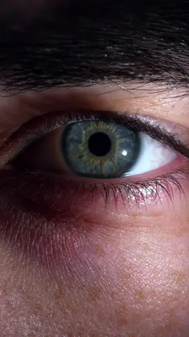 Blue eyes #heterochromia #blueeyes #cinematic #Inverted 