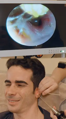 ASMR: Ear Cleaning with a Camera! At Angie Ear Spa Wellness SDN BHD in Kuala Lumpur!  #asmr #earcleaning #asmrearcleaning