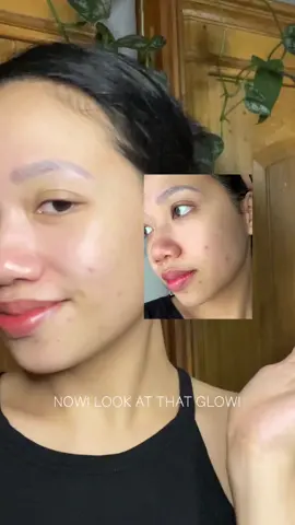 Real Progress pake moisturizer centella ini selama kurang lebih 2 minggu. Gilaaaaaa the power of right moisturizer for your skin tu beneran ngaruuuhh. Dah kalo kulit kalian oily, dan ada kemerahan plus lagi jerawatan, moisturizer ini nhampooool #acnepronemoisturizer #glad2glow 