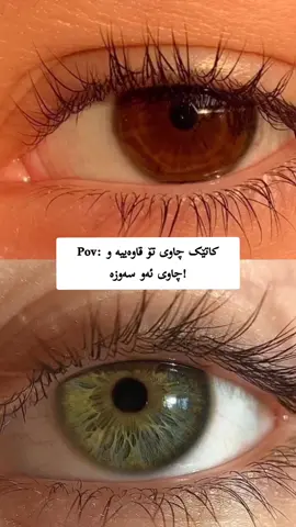 💚🤎 #fyp  #foryou #eyes #green #brown #greeneye #browneye #kurdistan #kurd #slemany #erbil #kalar #kfre #dhok #halabja #acctive #suli #tiktok 