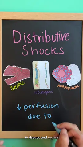 NCLEX review of the different types of shock ‼️ Hope you found this helpful nursing students! ##nursingstudent #nursingschool #visuallearning #hypovolemicshock #nclexreview #septicshock #anaphylacticshock #nursingeducation #nclex #nursingstudenttok #nursingstudentsoftiktok #nursetok #futurenurse #fyp #nurseready #nursingnotes #nursingmajor 