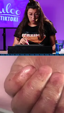 #paznokcie #nails #manicure #manicurehybrydowy #przedłużaniepaznokci #przedłużanie #viralnails #nailsartvideos #nail #nailart #nailtech #stylistka #stylistkapaznokci #paznokcieżelowe #paznokciehybrydowe #quloozdobienia #quloo #edytakruczak #viral #viralvideo #viraltiktok #trend #trending #trendingvideo #dc #dlaciebie #fyp #fypシ #fy