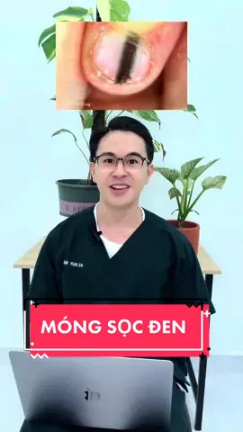 🌟MÓNG SỌC ĐEN #móngđangnóigì  #móngsọcđen #nail #melanoma #bshuymach #LearnOnTikTok #skincare 