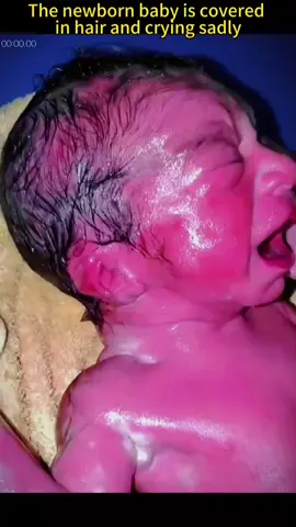 How many weeks are you pregnant? #pregnant #fetus #newborn #hair #cry #sad #foryou #fyp 