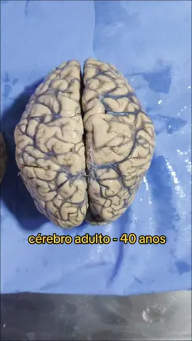 #patologia #pathology #neuroscience #medicina #medicine #brain 