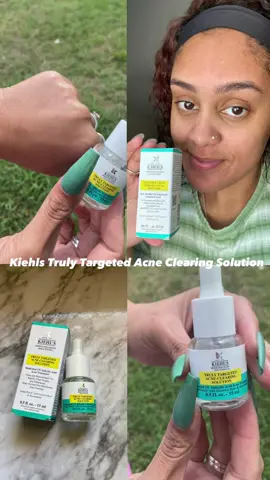 received this product for free from Influenster and Kiehls in exchange for my honest review. This product has worked tremendously for my skin. My nose is so much smoother. salicylic acids exfoliating properties fight to remove whiteheads and blackheads. I usually have hormonal breakouts, this will definitely be effective. I plan to continue use for future breakouts. @Kiehls @Influenster #Kiehls #GiftedbyKiehls #InvisiblepimplepPatch #PimplePatch 