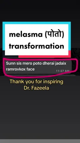Replying to @Dr. fazeela Abbasi ⛎ #aestheticjenny🧿 #jennyhere_jr #foryou #followmeformore 