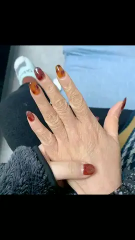 Esensi Asam Hyaluronic, melembabkan dan memutihkan tangan anda#hands 