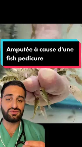 C'est vraiment dingue de se dire que quelque chose d’aussi anodin peut mener à de telles catastrophes #medical #prevention #fish #spa #poisson #infection #amputation #thailand #thailande #eau #vacances #skincare #soin #beauty #hopital #urgence #tiktokacademie #explications #bacterie #medecin #danger ##pedicure##manucure