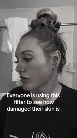 So I’ve been a sun worshiper my whole life and up until a year ago also a regular to the sunbeds. So either this filter is a gimmick or I’ve taken extremely good care of my skin 🤷🏼‍♀️ #skin #skincare #damagedskin #skinfilter #filterinstagram #filtertrends 