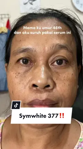 Kata mama andaii dulu ga makucrit 🥹 #flekhitam 
