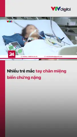 Gần 35.000 trường hợp mắc tay chân miệng và đã có 15 ca tử vong trên cả nước từ đầu năm đến nay. Đáng nói, có sự gia tăng tỷ lệ các ca dương tính với chủng EV71 #vtv24 #vtvdigital #tiktoknews #taychanmieng #songkhoe247