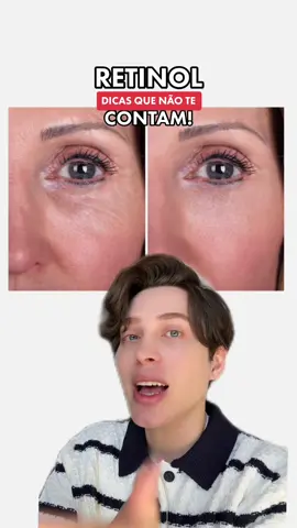 Retinol! Seguimos falando desse ativo incrível que eu amo! Dicas que não tem contam! Vem #skinarmy #longervideos #skincare #retinol #acidoretinoico #retinolskincare #skincaretiktok #tiktokbeleza #rotinadepele #skincarebrasil #peleoleosa #pelemadura #peleacneica 