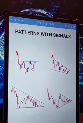 #Forex #forextrading #tiktokforex #forexlifestyle #forexpatterns 