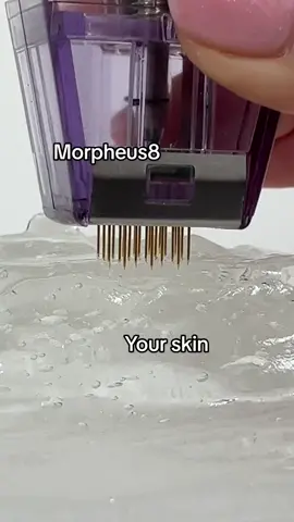 This is how deep Morpheus8 can go in your skin! Keep in mind the needle depth can be altered for each patient’s skin goals #morpheus8 #microneedling #fyp #foryou #skincare 📸 @Doctor Andre 