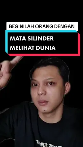 oh ternyata berbayang kaya gini 🤔 | sc yt : viooopticalclinic #fyp #foryou #faktaunik #infounik #samasamabelajar 