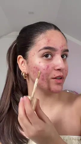 kann bitte wieder die sonne scheinen #grwm #girls #akne #realskin #flawlessfilter #charlottetilbury 