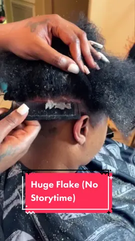 Replying to @🤍🔝 Huge Flake!! Video by Hairbyprettyaz_nae on Youtube!! #dandruff #dandruffremoval #dandruffproblem #soothing #anxiety #foryou #satisfying #fyp #viral #dandruffscratching 