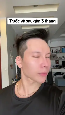 Trước và sau gần 3 tháng kiên trì #manhvu #manhtute #drking #serummoclongmay #duonglongmay 