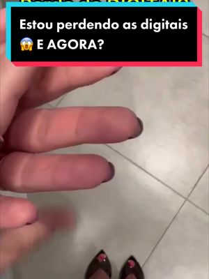 Conteúdo de ouro pra vocês 😱 Sabiam que as alergias pode causar a PERDA DE DIGITAL? #curiosidades #disidrose #maosepes #disidroseemocional #unhas #alergias #saude #fypシ #fy 