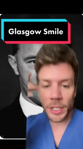 The Glasgow Smile or Chelsea Smile! Such a horrible injury with potentually long term implications! #glasgowsmile #injury #hospital #face 