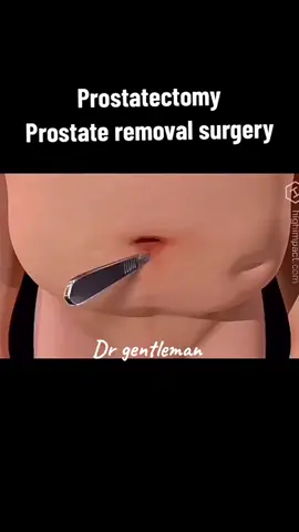 repost don't delete my vedio 🥰#foryou #foryoupage #3d #animation #prostat 