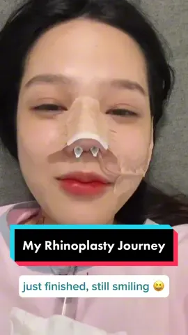 rhinoplasty journey #rhinoplasty #koreasurgery #nosesurgery #dubaiclinic #jisooclinic #nanoform 