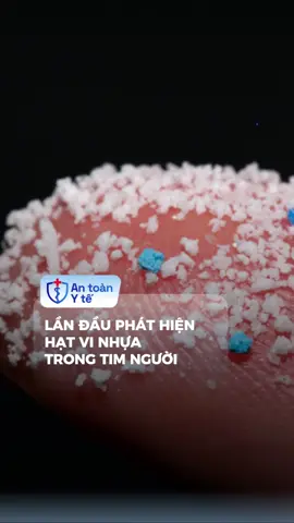 Phát hiện hạt vi nhựa trong tim người #antoanyte #tiktoknews #songkhoe247 #nl 