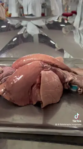 #recrutamentopulmonar #fisio #recrutamentoalveolar #anatomia #pulmao #fisioterapeuta #pulmão #fisioterapia #anatomiapulmonar #anatomiahumana #enfermagem #anatomy #sistemarespiratorio #sistemarespiratório #fh♿️ 
