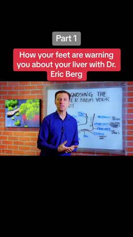 How your feet are warning you about your liver problems - Dr. Eric Berg  . . . . . . #guthealth #heal #holisticmedicine #causesofinflammation #healthy #drericberg #foryou #fypシ #fypシ゚viral #chronicinflammation #howtoheal #liverproblems #healyourliver 