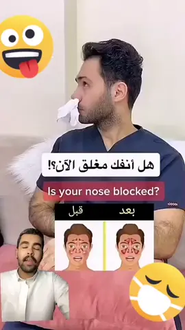 طريقة جيدة👌#للزكام#افضل_علاج_للزكام #لا للزكام#لا_للزكام_ 