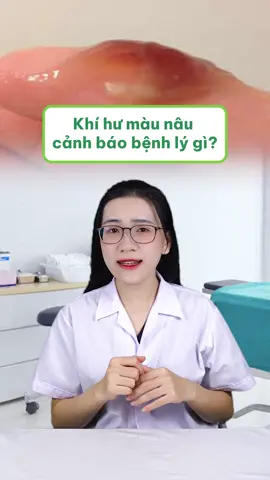 Khí hư màu nâu cảnh báo điều gì dọ? 🫣🫣  #LearnOnTikTok #menvisinh #lavima #lavimabiotic #suckhoephunu #lamdeptainha #xuhuong #fyp #phunu 