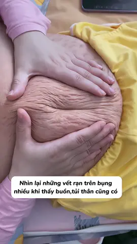 Vì con nỗi đau nào mẹ cũng vượt qua được đúng không các mom #rạndasausinh #chuyệnmangthai #mebau 