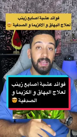 ‎يارب تنجح في حياتك لو عملت إكسبلور واحد أحبكم ❤️                                             #fyp #fypシ #fypage #fypシ゚viral #viral #viralvideo #fyt #foryou #foryoupage #foryourpage #viral #viralvideo #viraltiktok #maroc #الصحة #الأناقة_و_الجمال #وصفات #وصفات_طبيعية #أكادير #دير_الخير_ونفع_الغير 