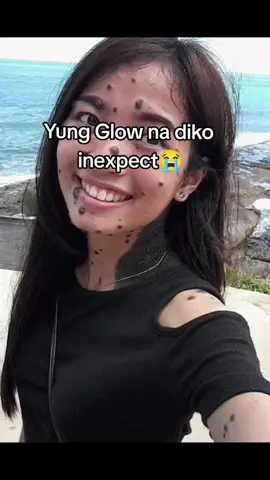 Ito na inaantay nyong glow up mga mare ko🤗 #fyp #mole #moleremoval #fypage